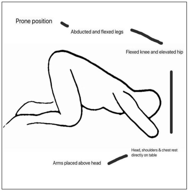 Knee-Chest Position untuk Mengatasi Letak Sungsang / Letsu